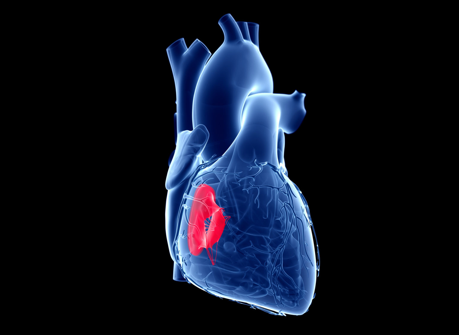 novel-and-less-invasive-options-for-tricuspid-valve-regurgitation-now