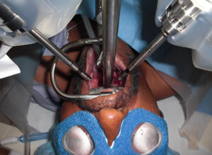 current study on oral robotics surgery