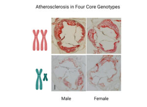 atherosclerosis in male and female arteries