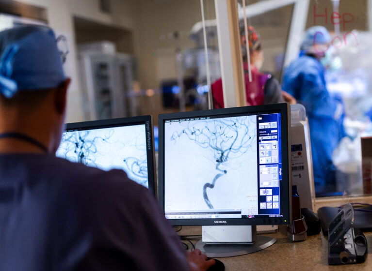 doctor looking at scans of brain