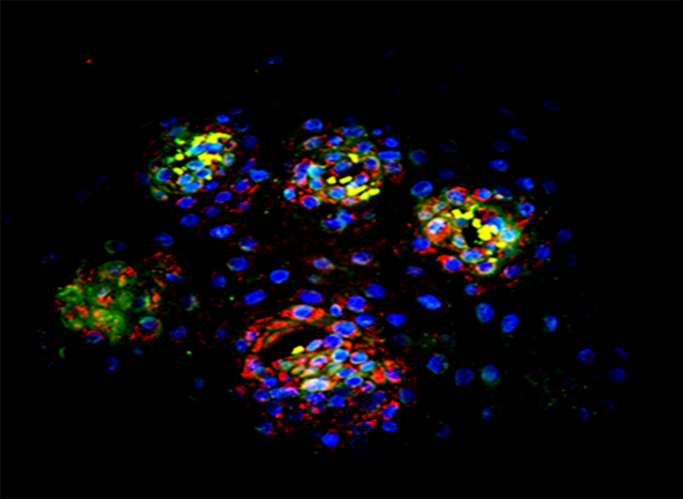 IgG4 responding to wheat on a cell